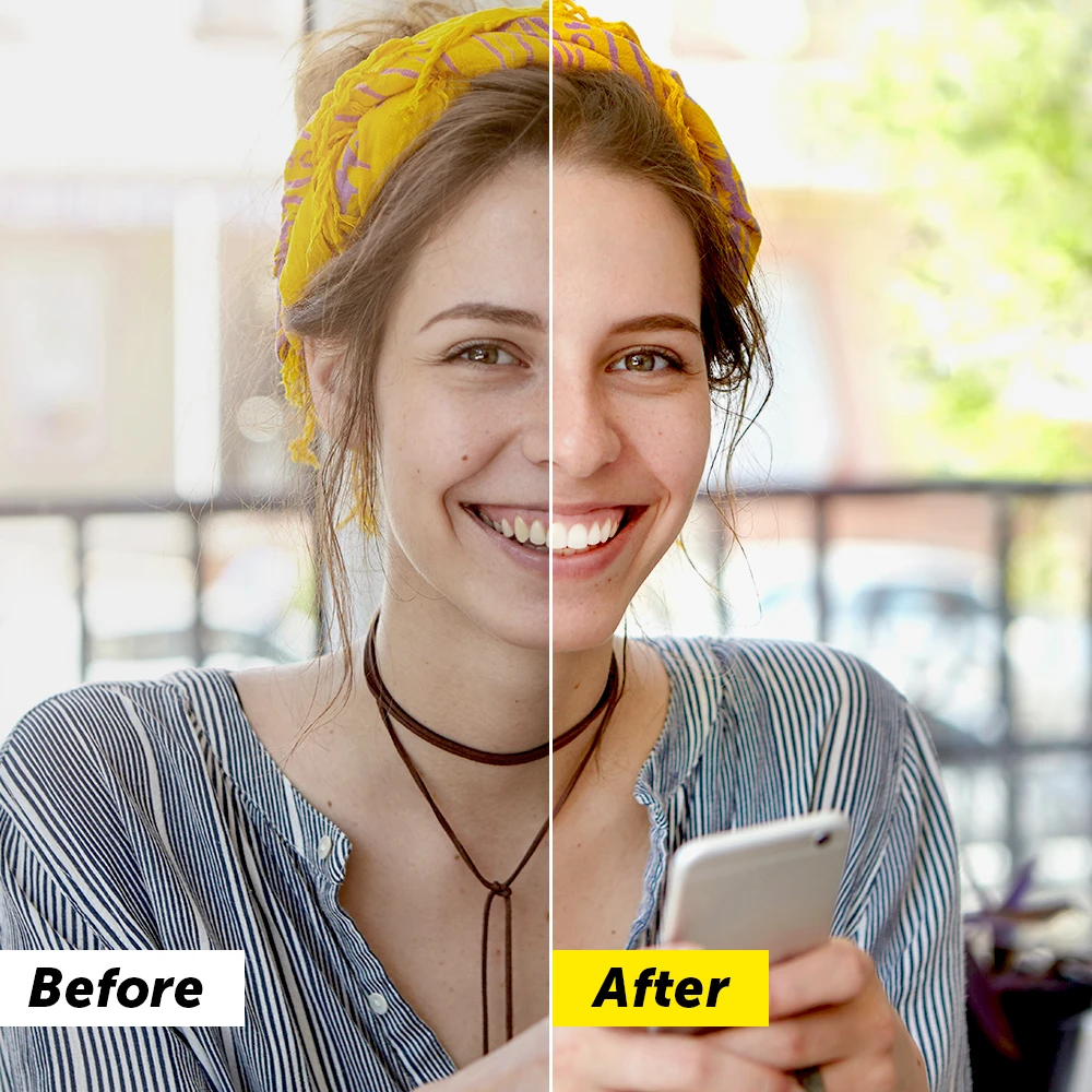 Teeth whitening before and after photo