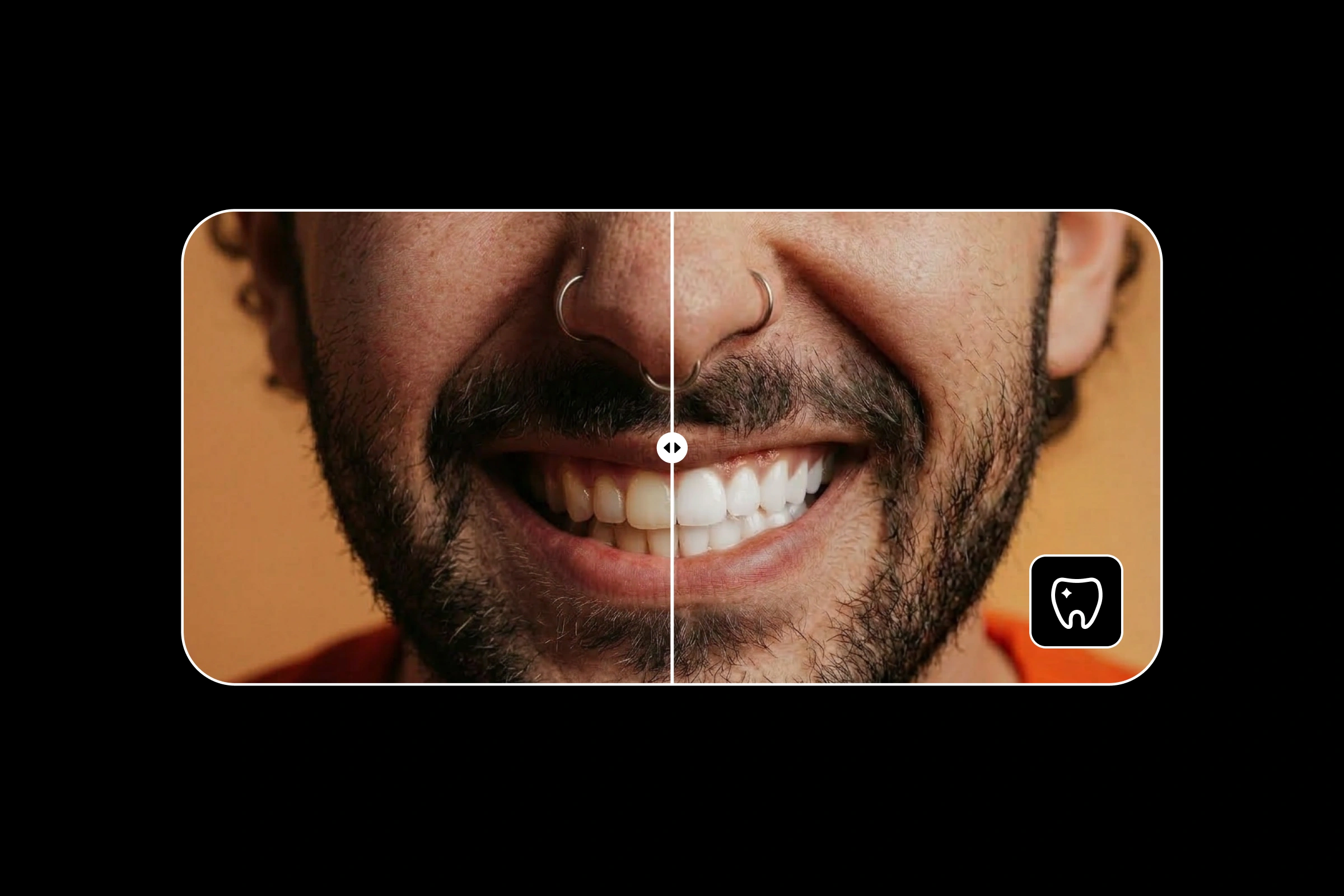 How to Whiten Teeth in Photos With Picsart AI Retouch