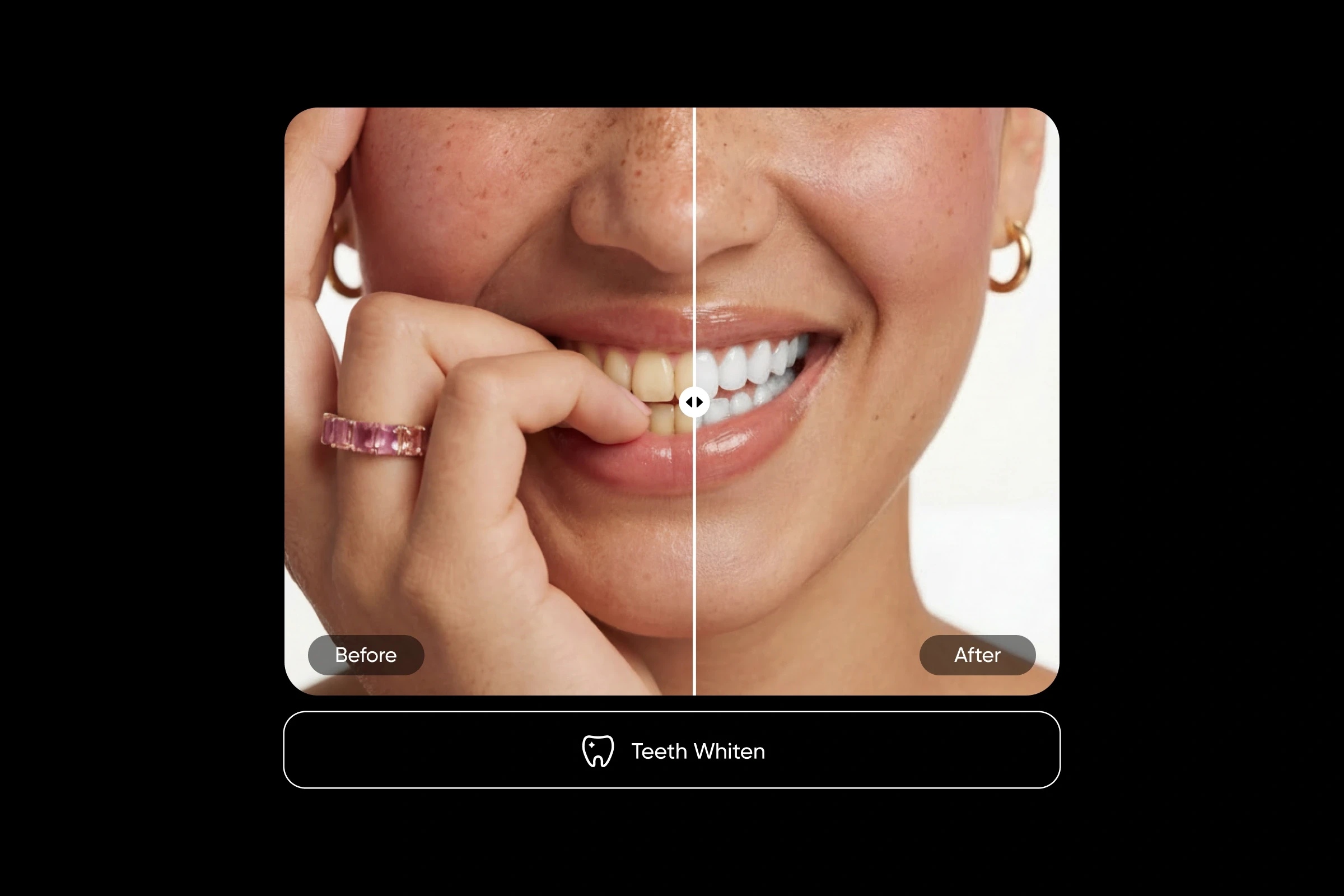 Whiten teeth in photos use case example